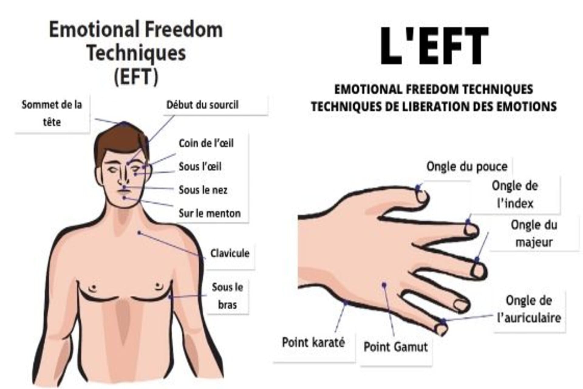 Les Chocs de la Vie et l’EFT : Un Outil de Libération Émotionnelle